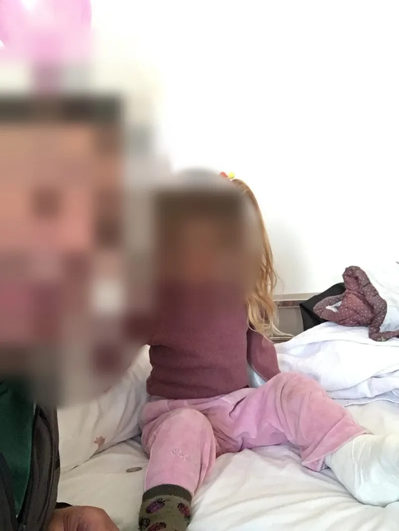 Sevannah as a little girl, recovering after treatment (face blurred)